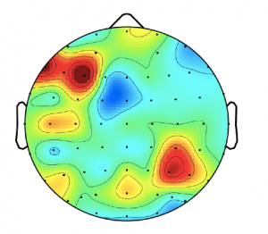 Image showing brain resonance response